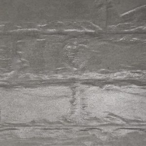 Everest Artestone Wall Cladding